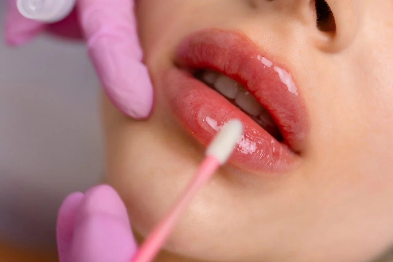 Preenchimento Labial